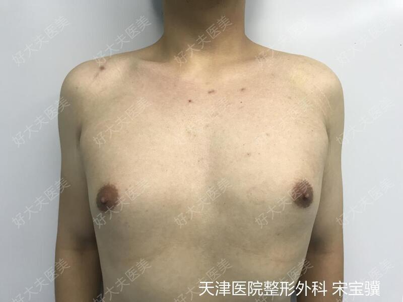 圖文圖片