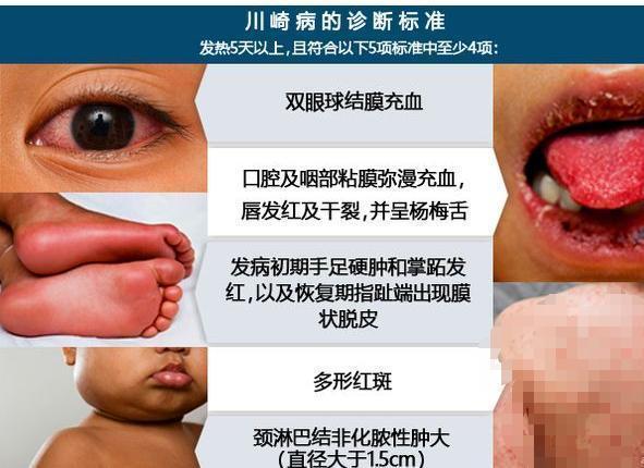 圖文圖片