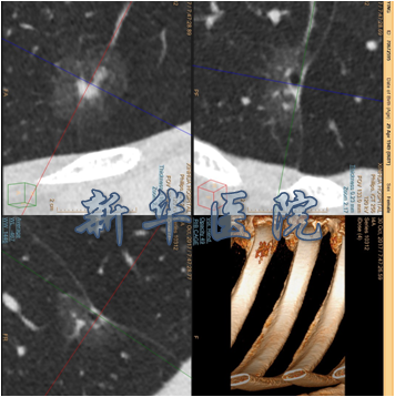 uoYBAF5rjfaAPuvfAAKH2adZ5i0693.png?_ms_=4625