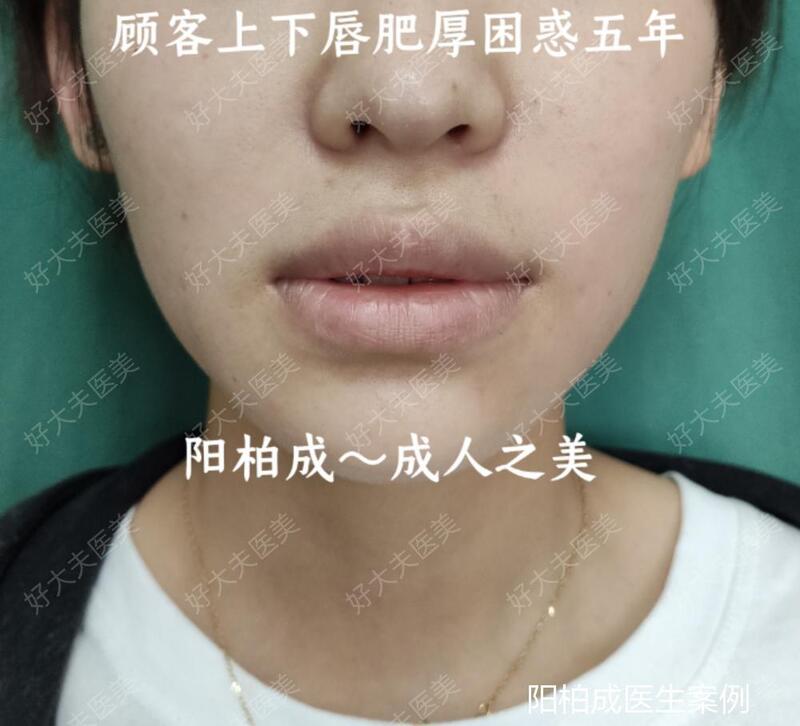 圖文圖片