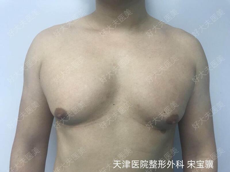 圖文圖片