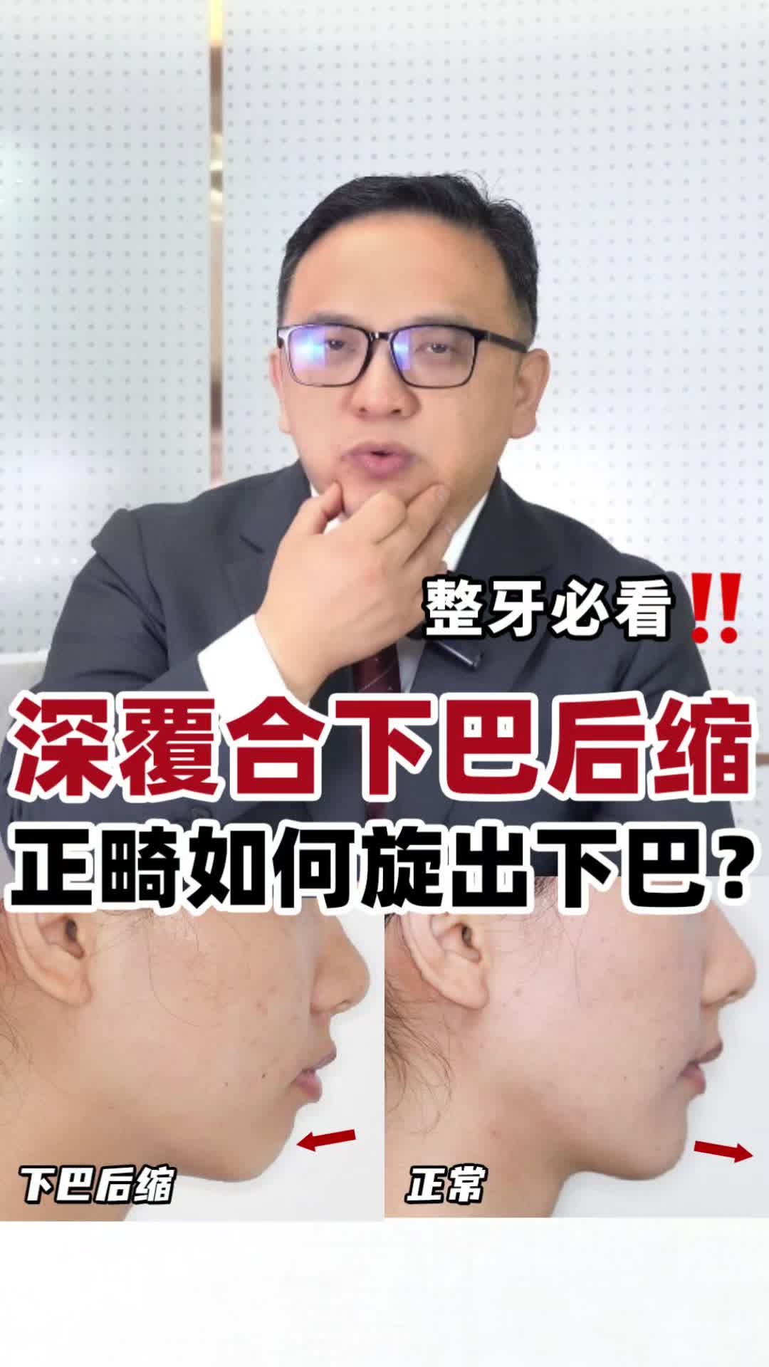 視頻封面