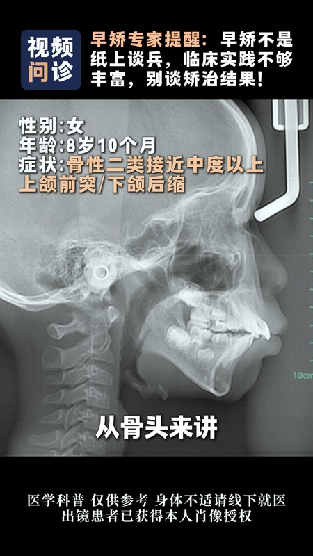 視頻封面