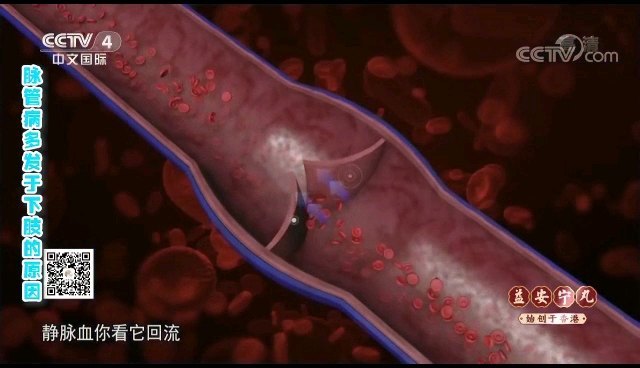 周围血管病为什么多见于下肢？