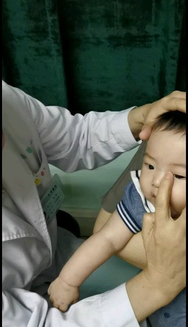 泪囊按摩的正确做法