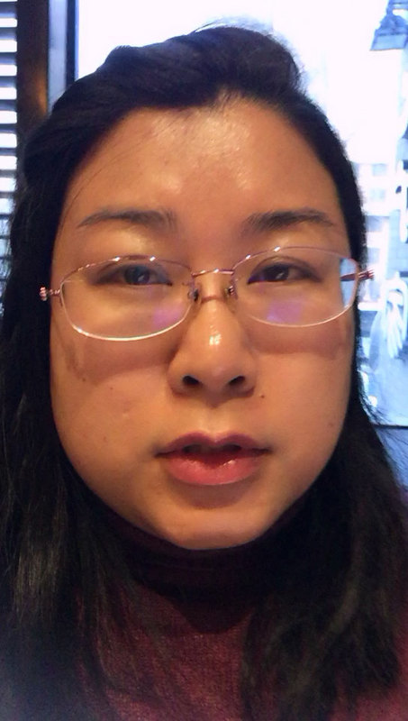 川崎病的病因