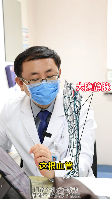 静脉曲张射频手术，是需要都大小隐静脉都封闭吗？