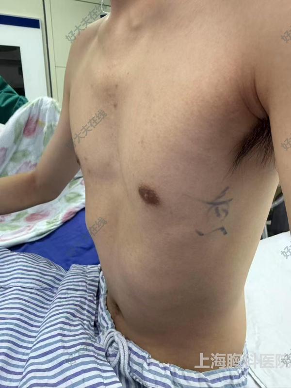 圖文圖片