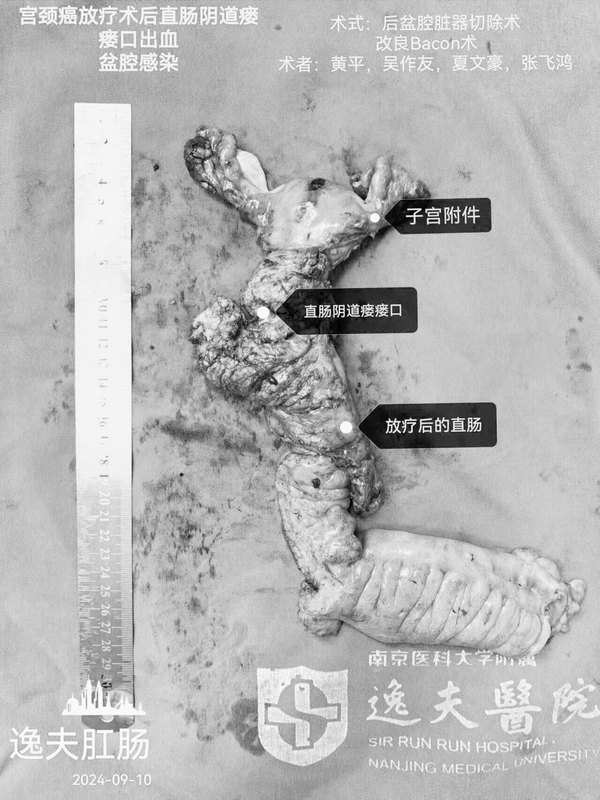 圖文圖片