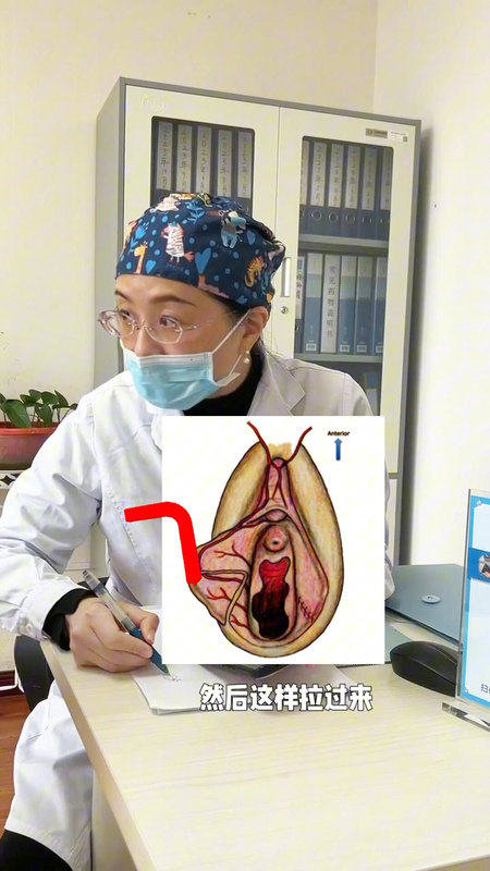 小阴唇手术方法如何选择呢？边缘弧形切 OR 楔形切？＃郑州市第一人民医院