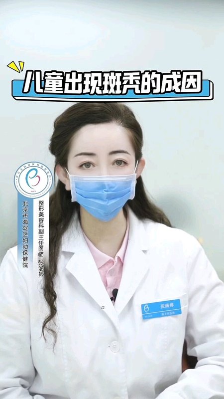 儿童斑秃