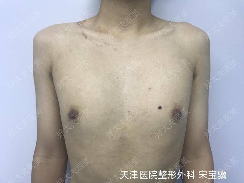 圖文圖片