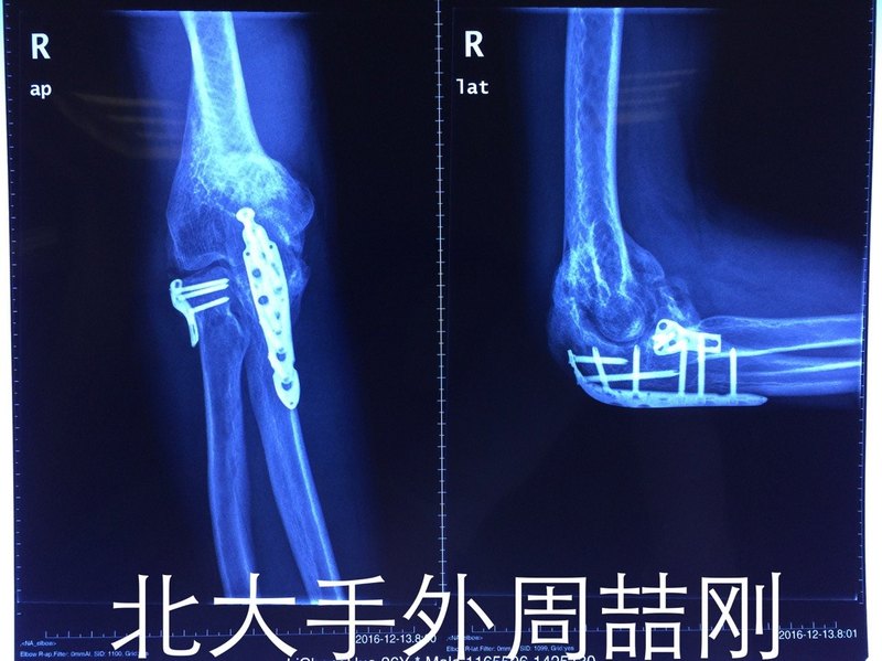 圖片