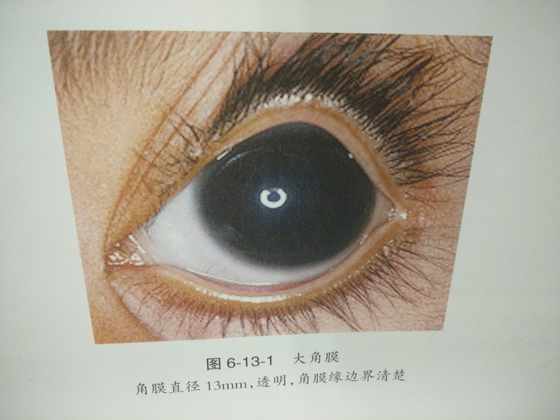 圖文圖片