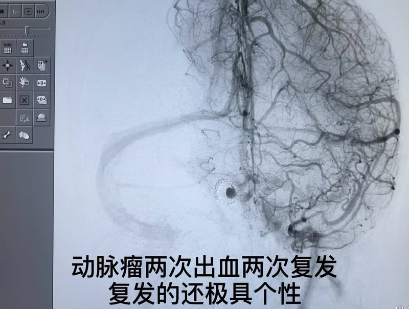 視頻封面