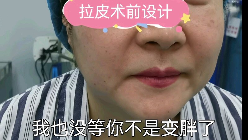 視頻封面