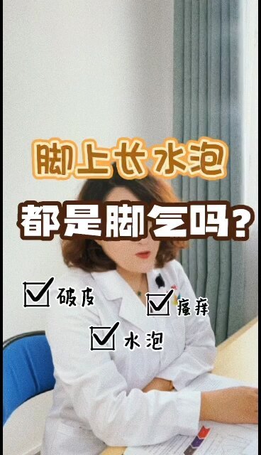 脚上长水疱都是脚气吗？