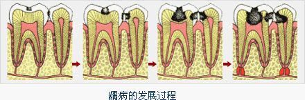 圖文圖片