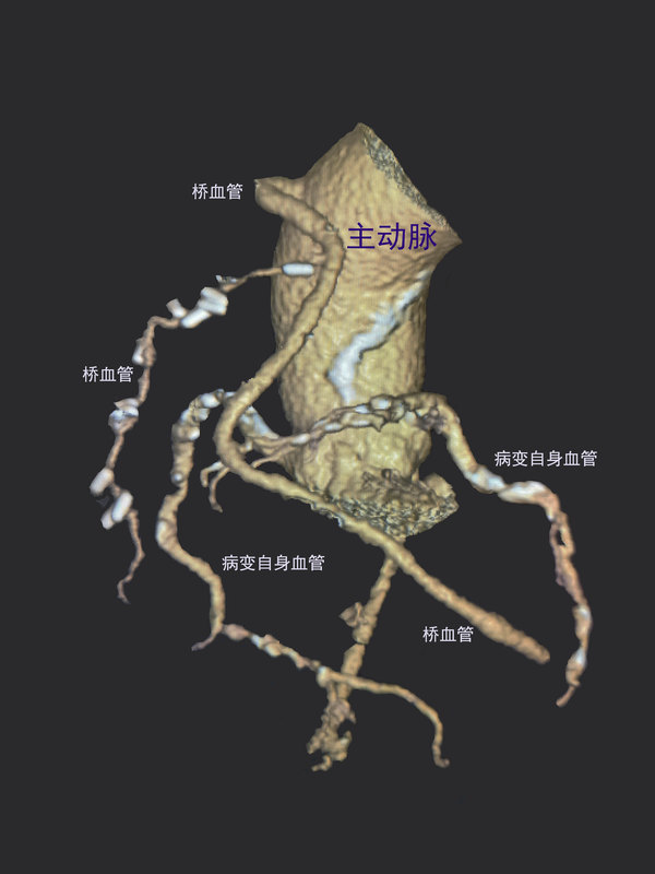 圖文圖片