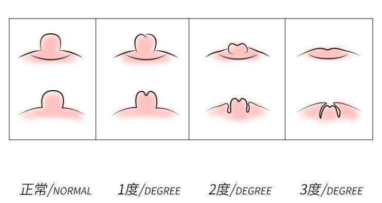 圖文圖片