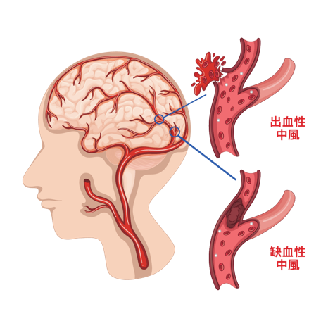 宣武医院预约专家核磁加急-北京宣武医院做核磁共振用排队吗 