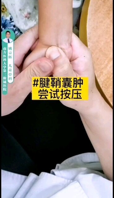 宝贝手上长了个花生米大的腱鞘囊肿 ，还没来得及哭就消失了，哈哈！
