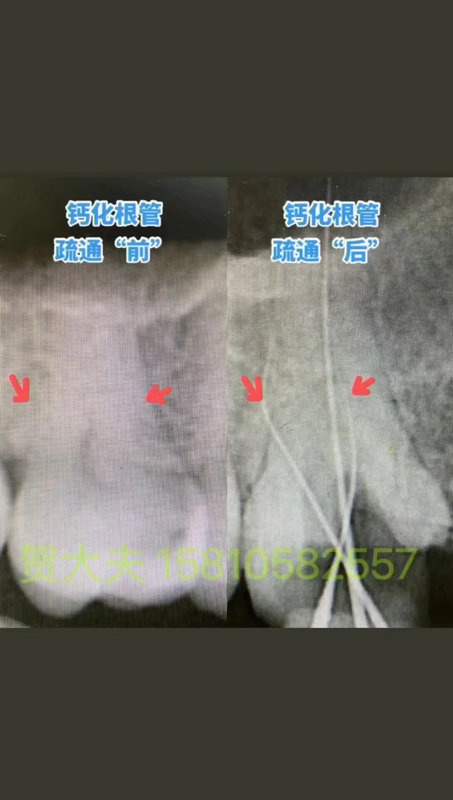 視頻封面