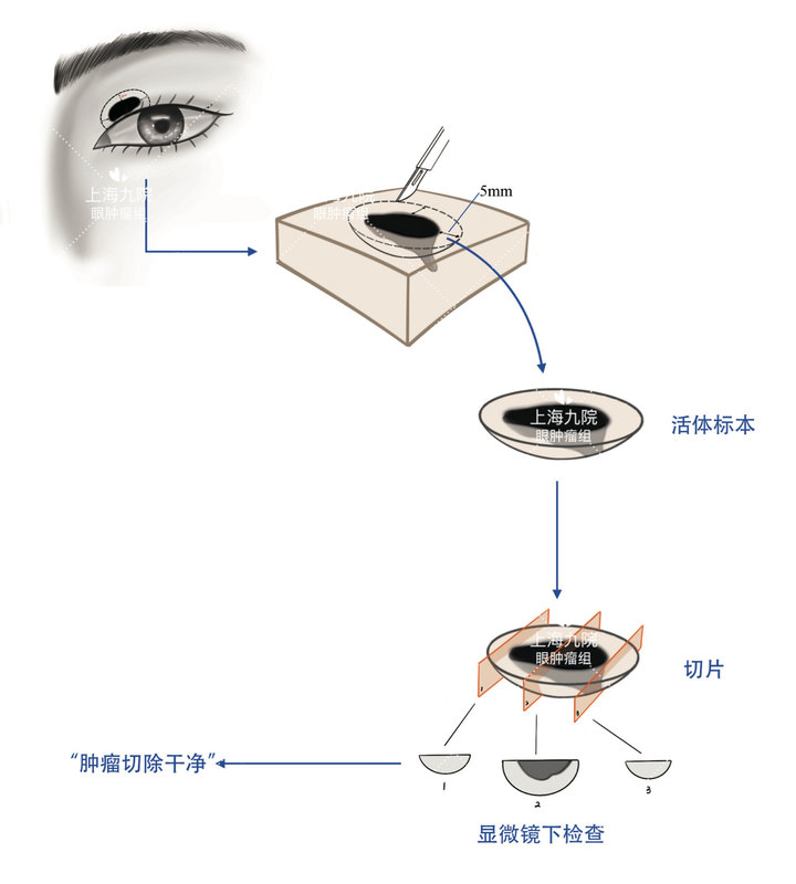 圖文圖片