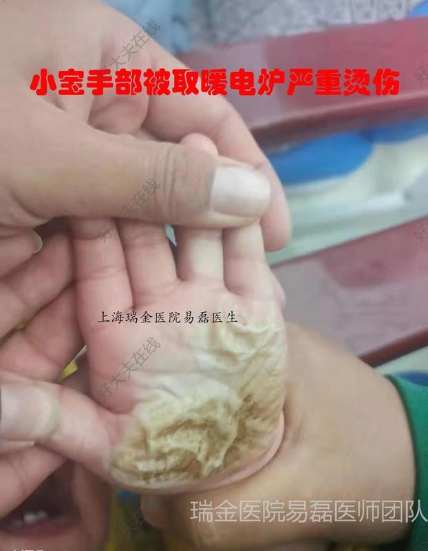 圖文圖片
