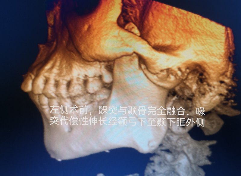 圖文圖片