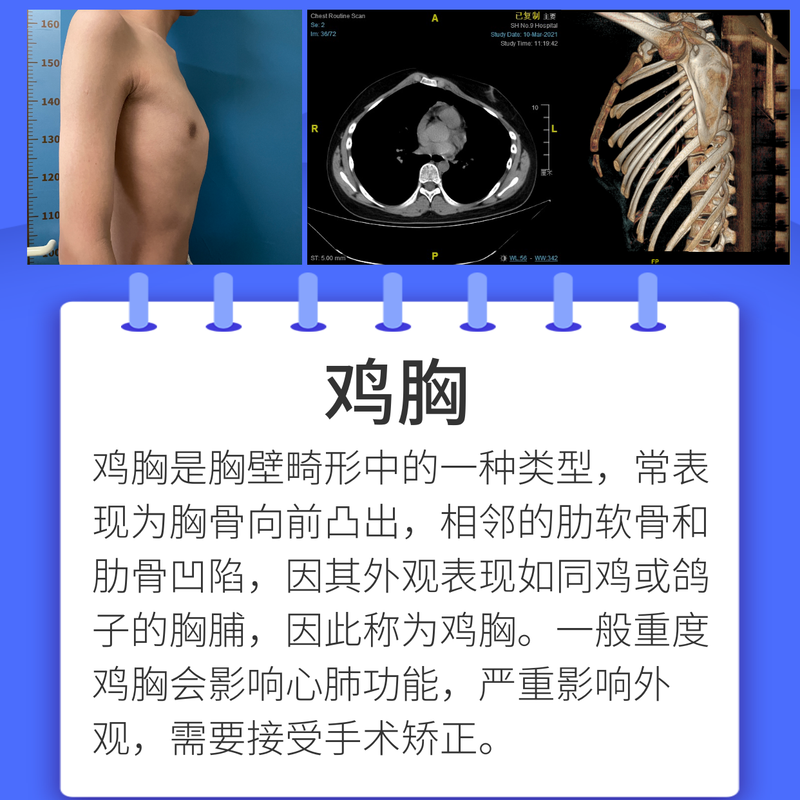 圖文圖片