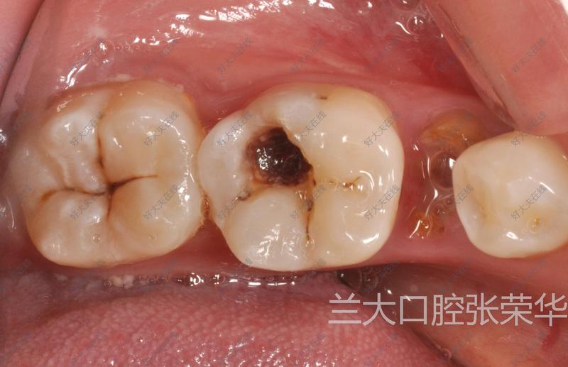 圖文圖片
