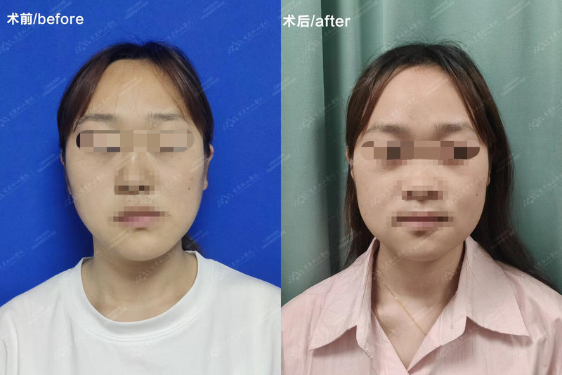圖文圖片