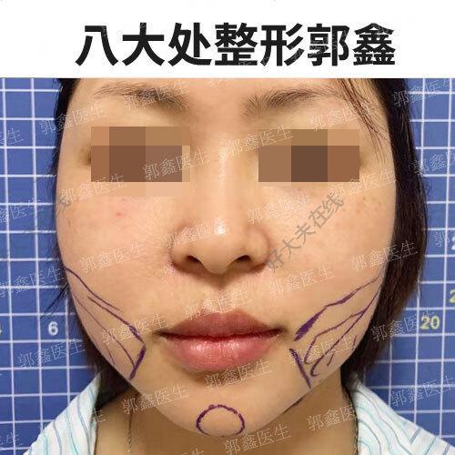 圖文圖片