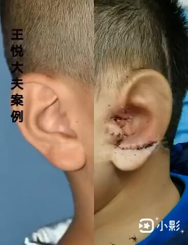 分享一例全包法案例