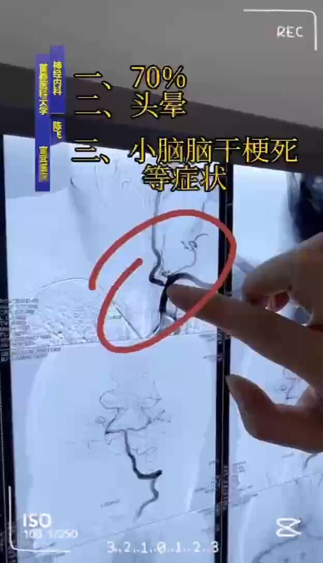 視頻封面