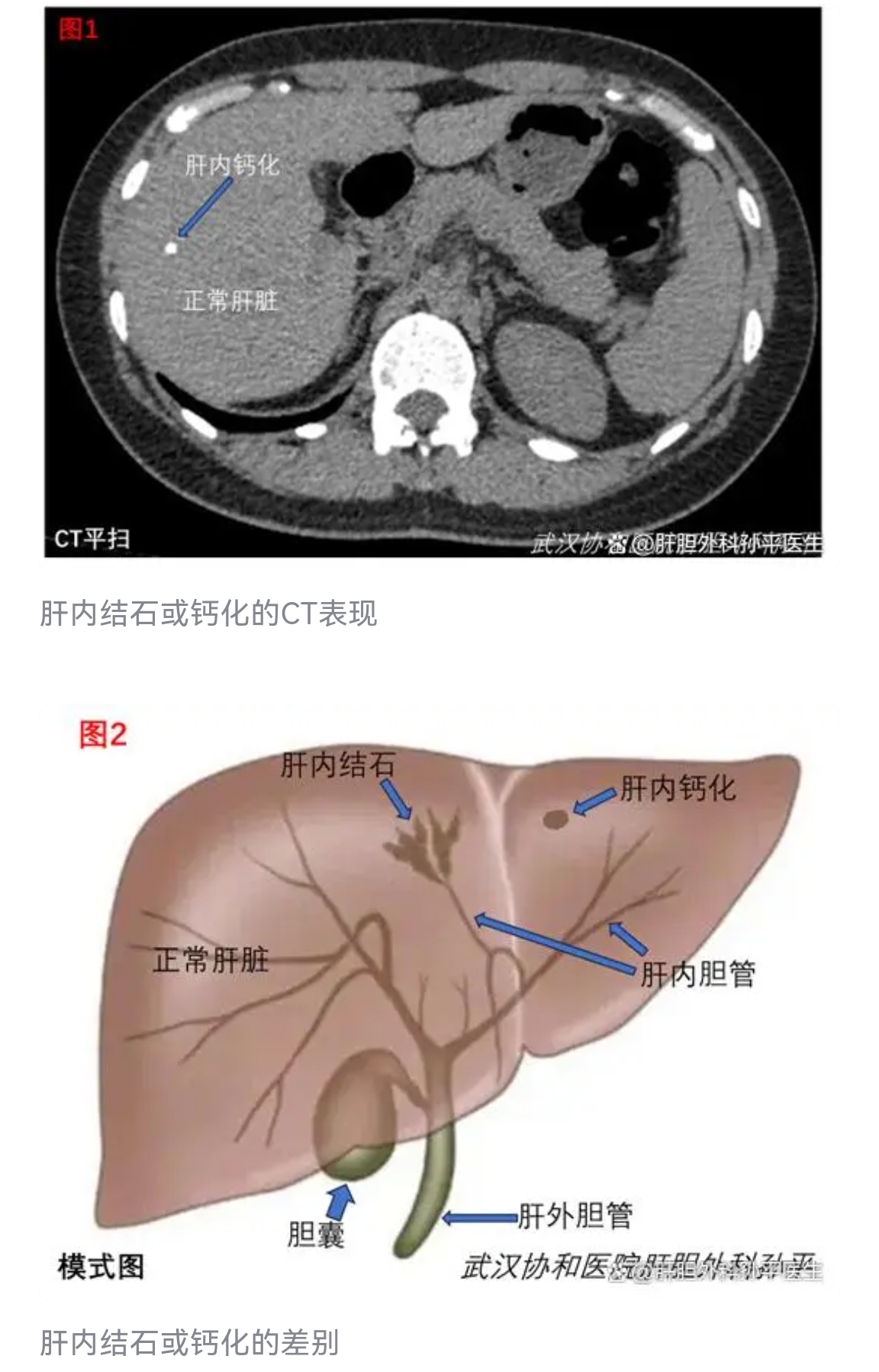 圖文圖片
