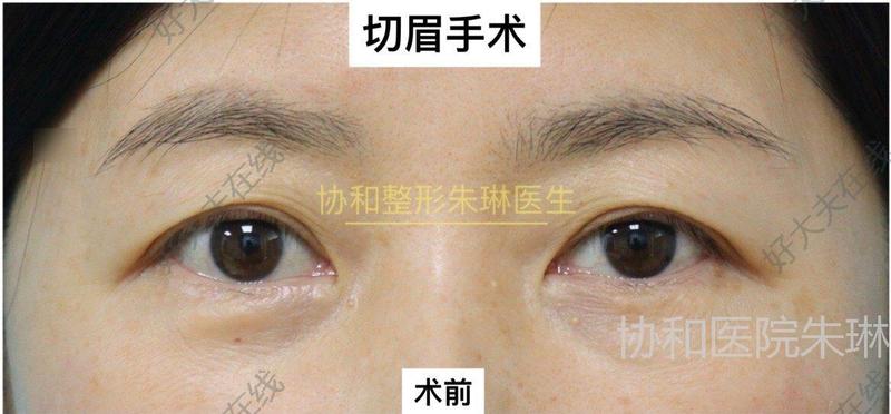 圖文圖片