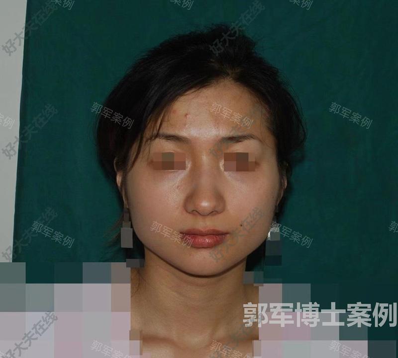 圖文圖片