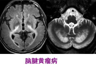 圖文圖片