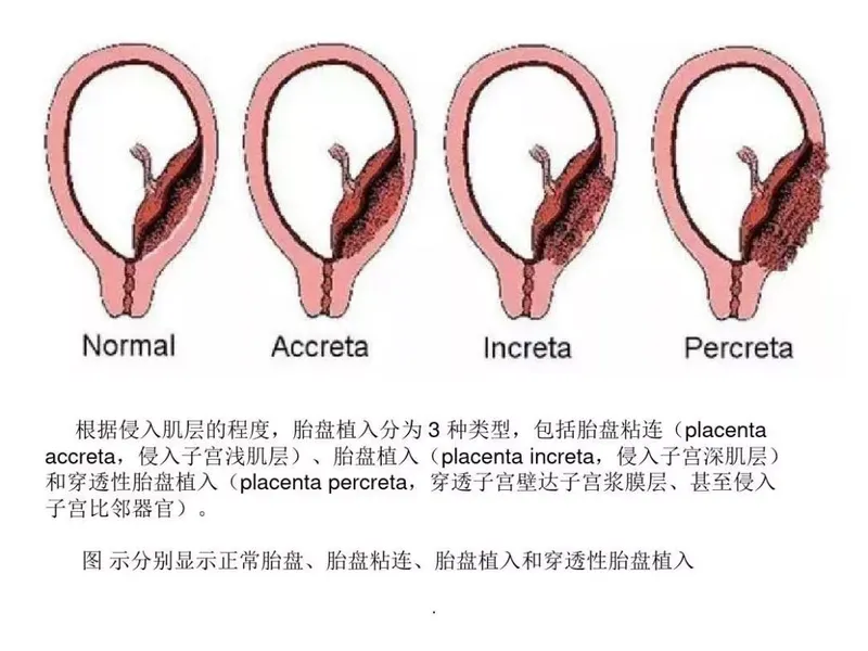 圖文圖片