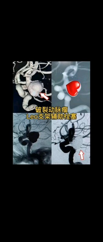 視頻封面