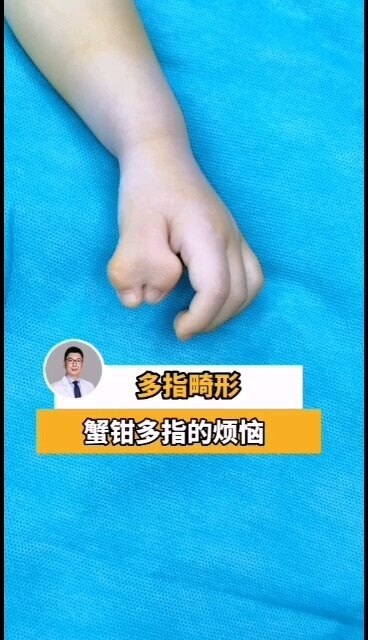視頻封面