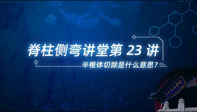 【脊柱侧弯讲堂】第23讲：半椎体切除是什么意思？