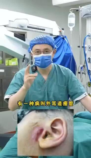 耳前瘘管特殊类型-外耳道瘘管