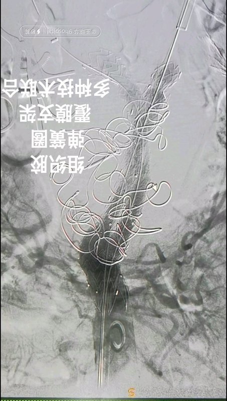 視頻封面