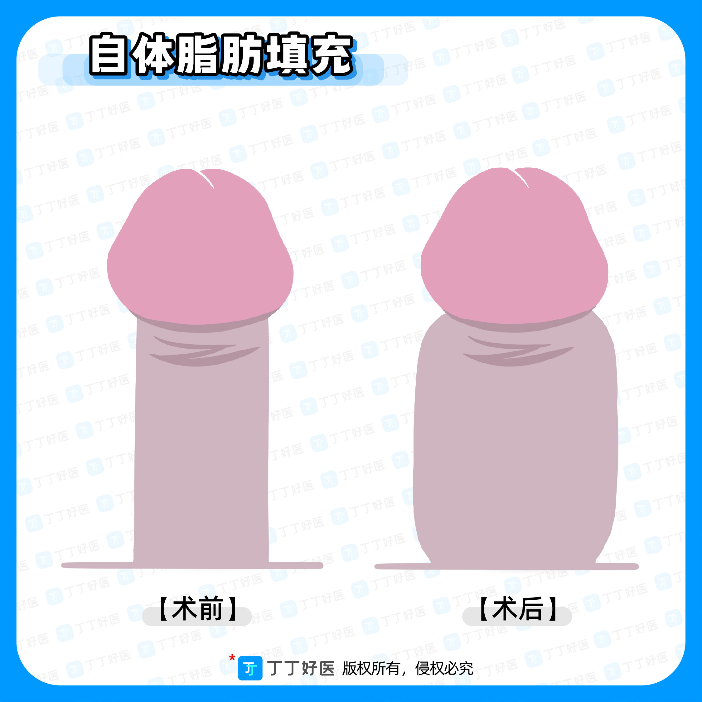 圖文圖片