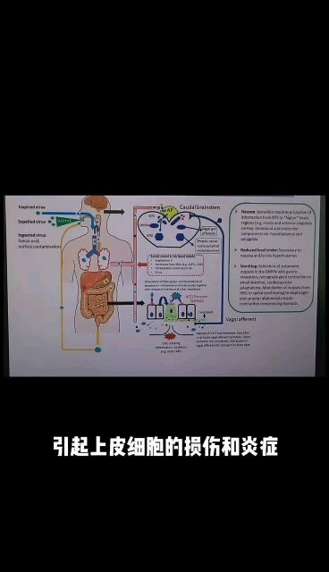 新冠引起恶心的机制