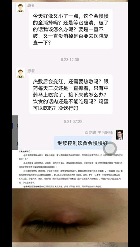 霰粒肿发现早保守治疗有效