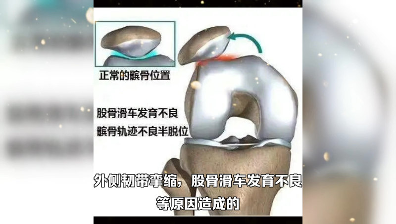 視頻封面